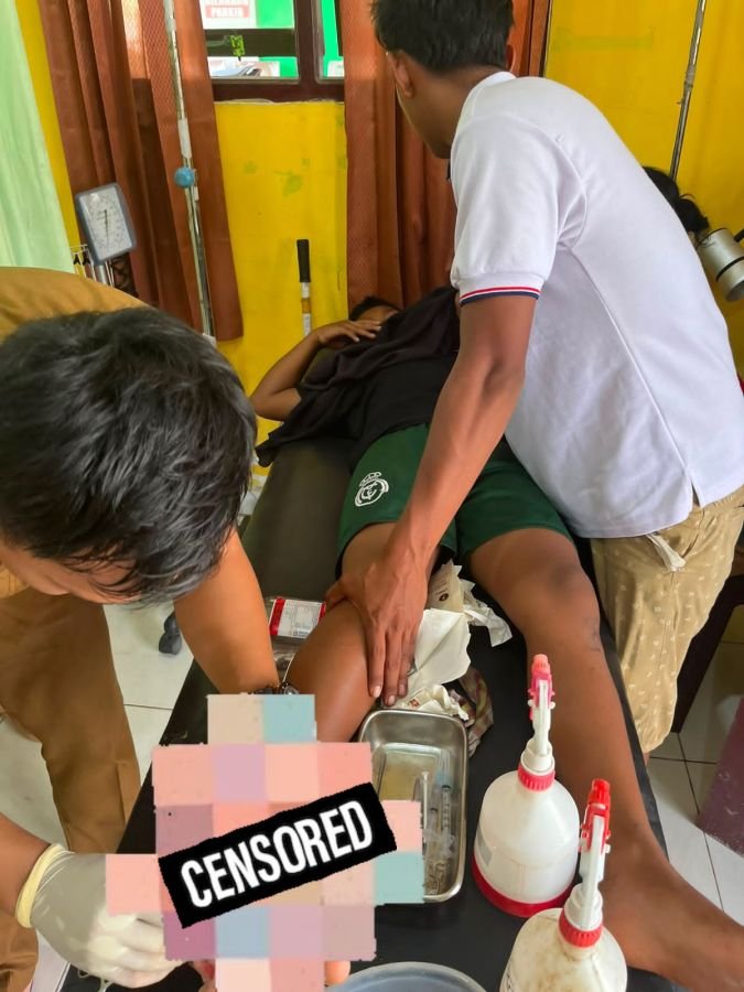 Buaya Serang Dua Anak di Betara, Satu Tewas